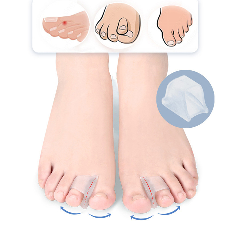 1Pair Soft Silicone Gel Toe Separator Hallux Valgus Bunion Thumb Corre$7 f 1Pair Soft Silicone Gel Toe Separator Hallux Valgus Bunion Thumb Corre$7 f